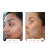 sensitive skin, turmeric face mask, glow mask 