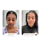 Dry skin facial mask, hyperpigmentation treatment, dull skin, acne transformation, acne treatment, glass skin